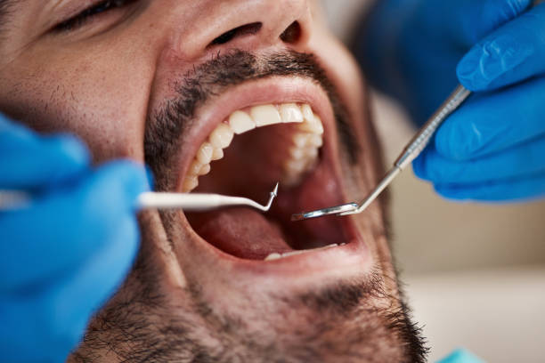 Best Emergency Dental Care for Abscessed Tooth in Minturn, CO